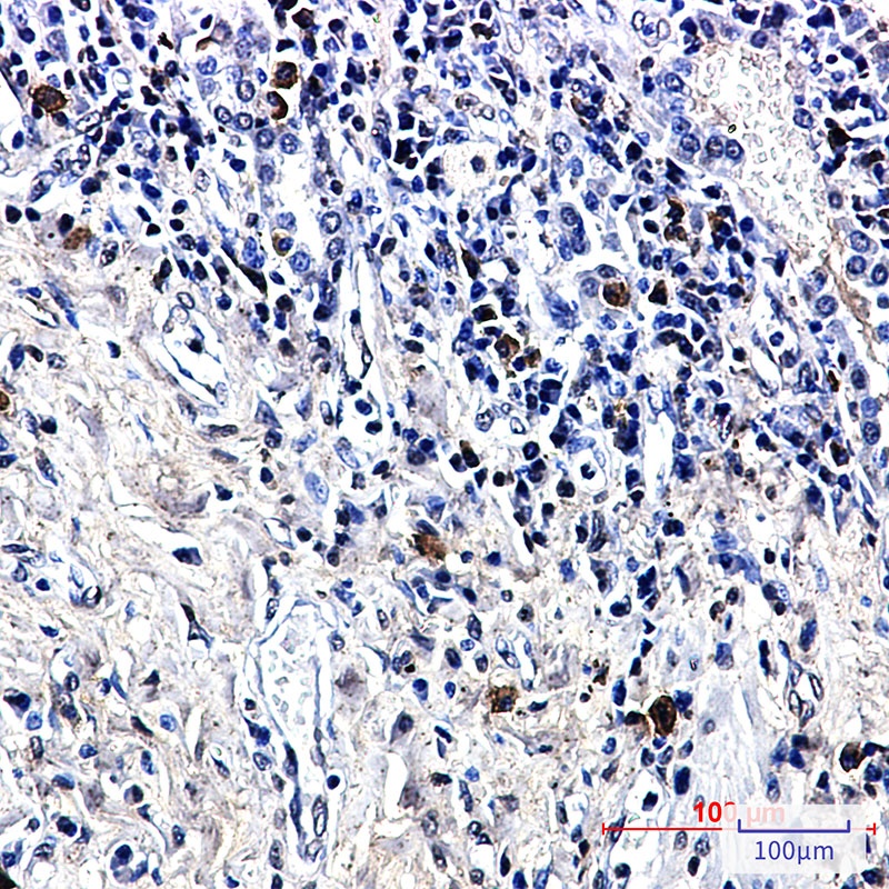 LTK Rabbit mAb