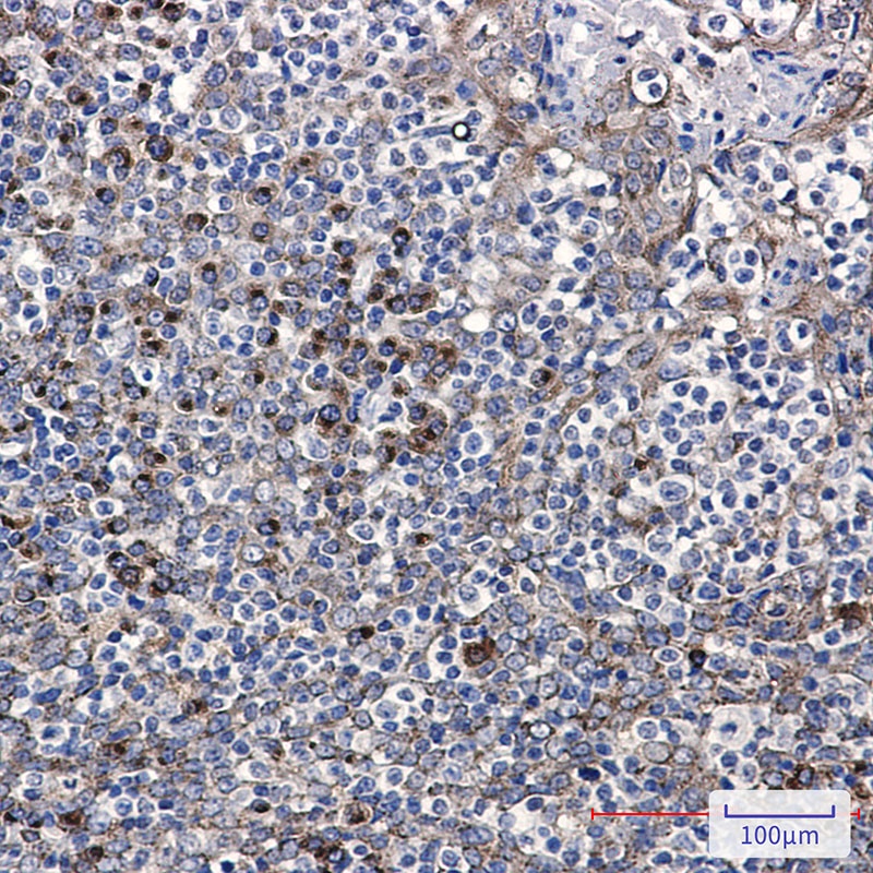 LMAN1 Rabbit mAb