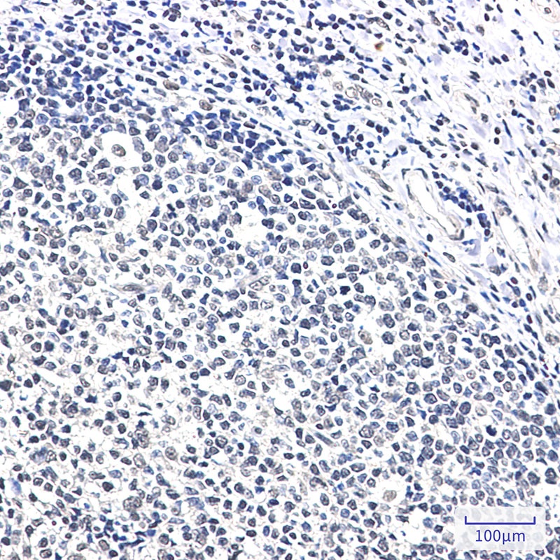XRCC6 Antibody