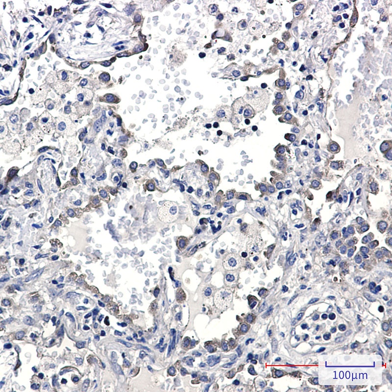 KIFAP3 Rabbit mAb