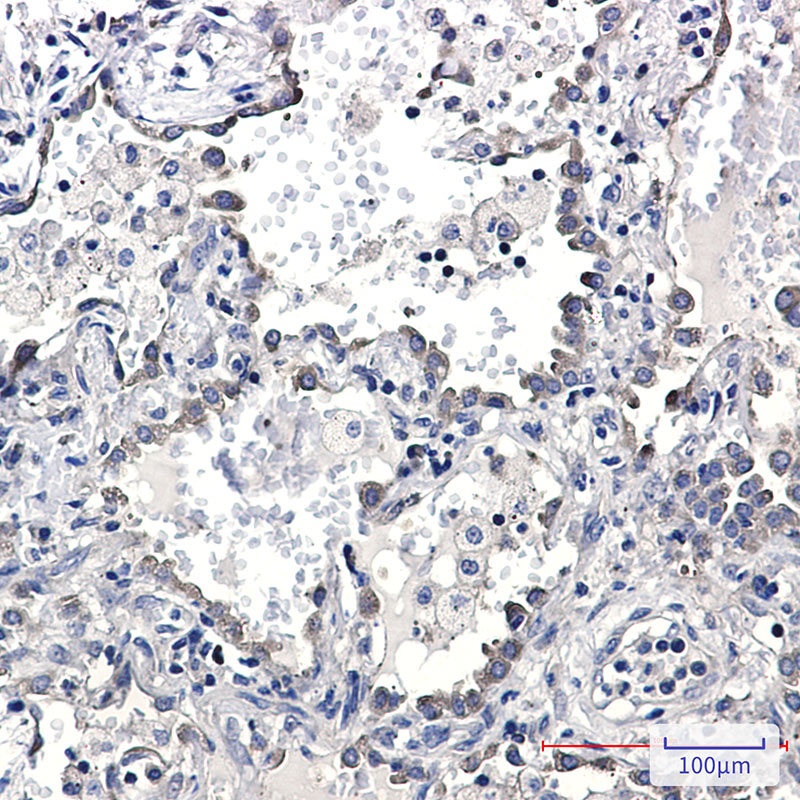 KIFAP3 Antibody