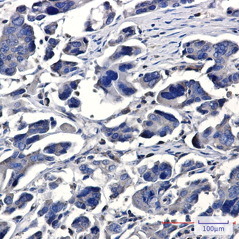 IQGAP2 Antibody