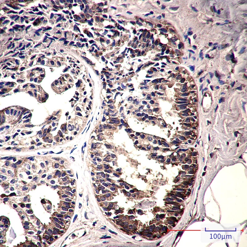 IMPDH2 Antibody