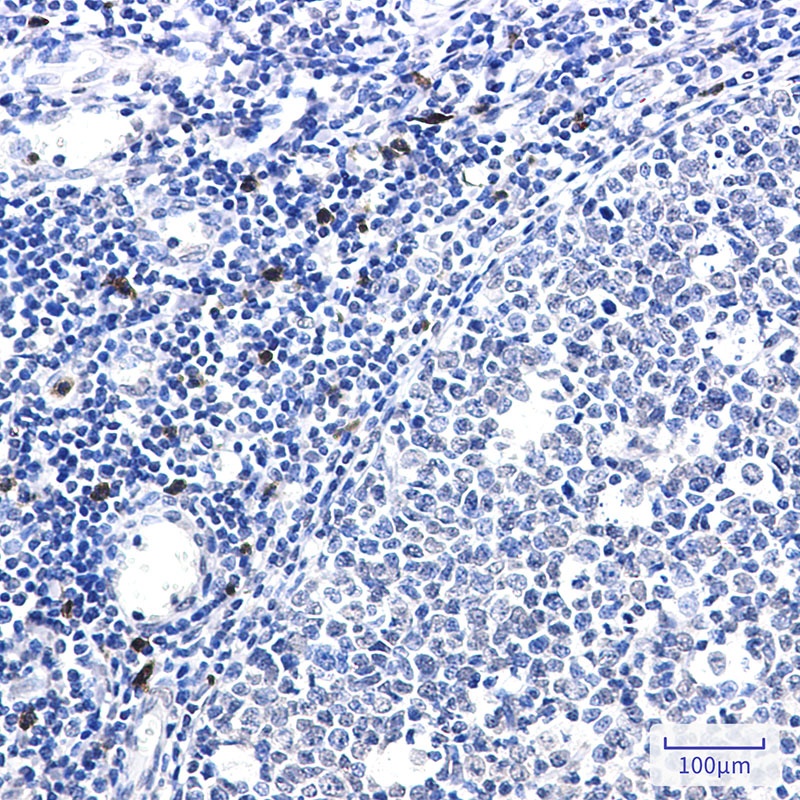 IL26 Antibody