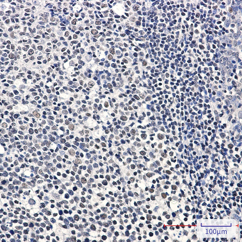 IKZF3 Rabbit mAb