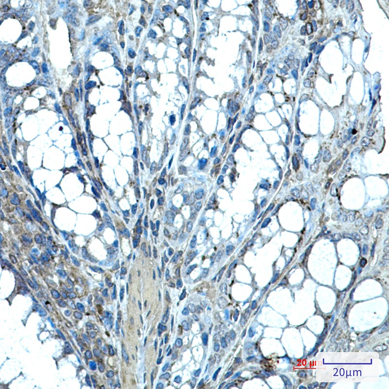 IHH Antibody
