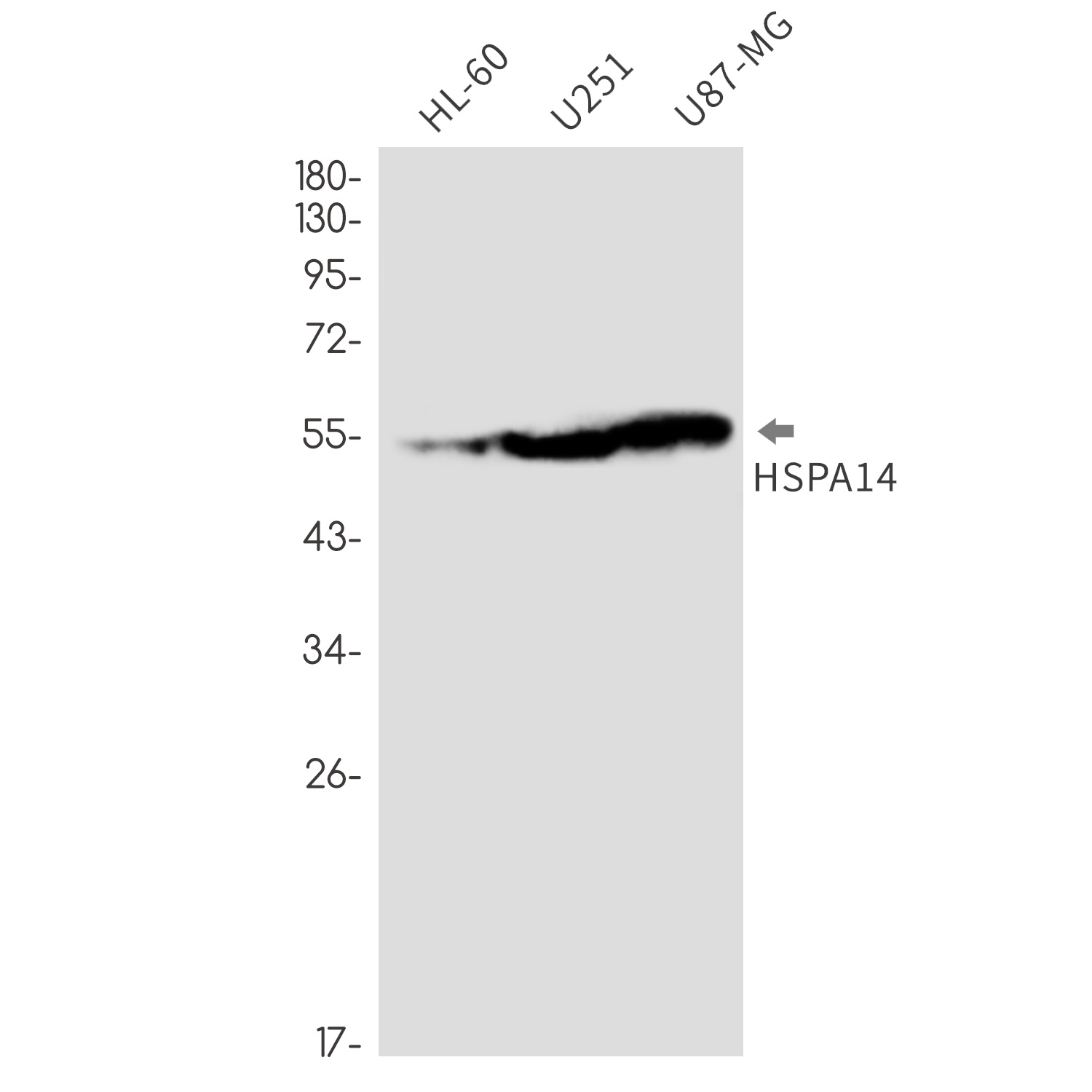 HSPA14 Antibody