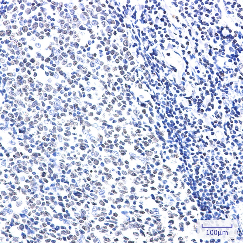 HMGB2 Antibody