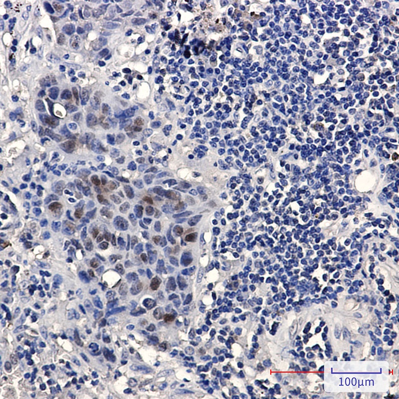HMGB3 Antibody