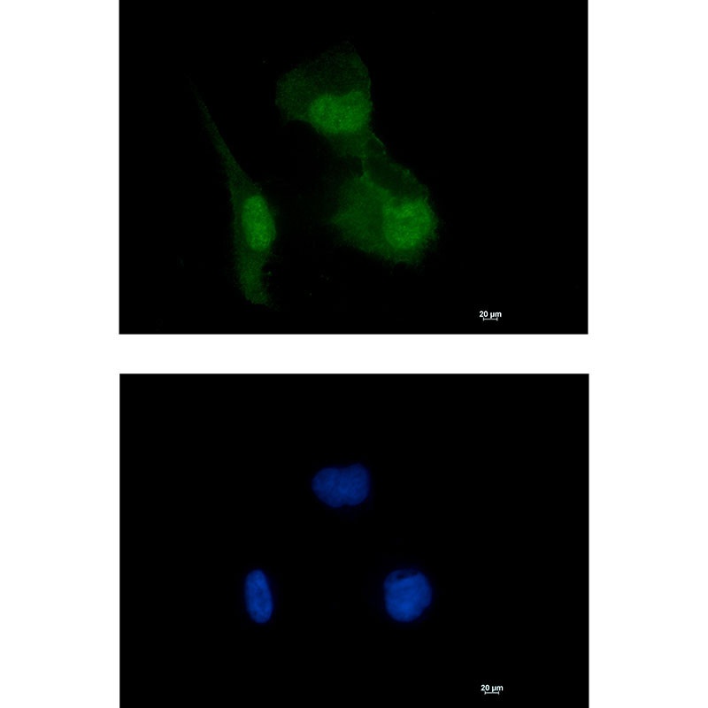 HIF1AN Antibody