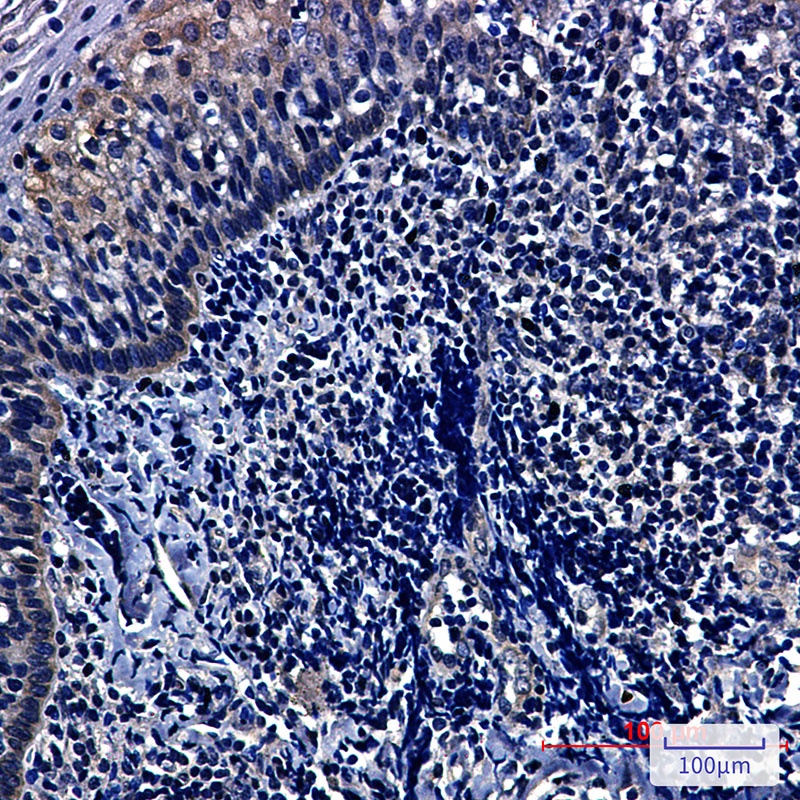 HIF1AN Antibody