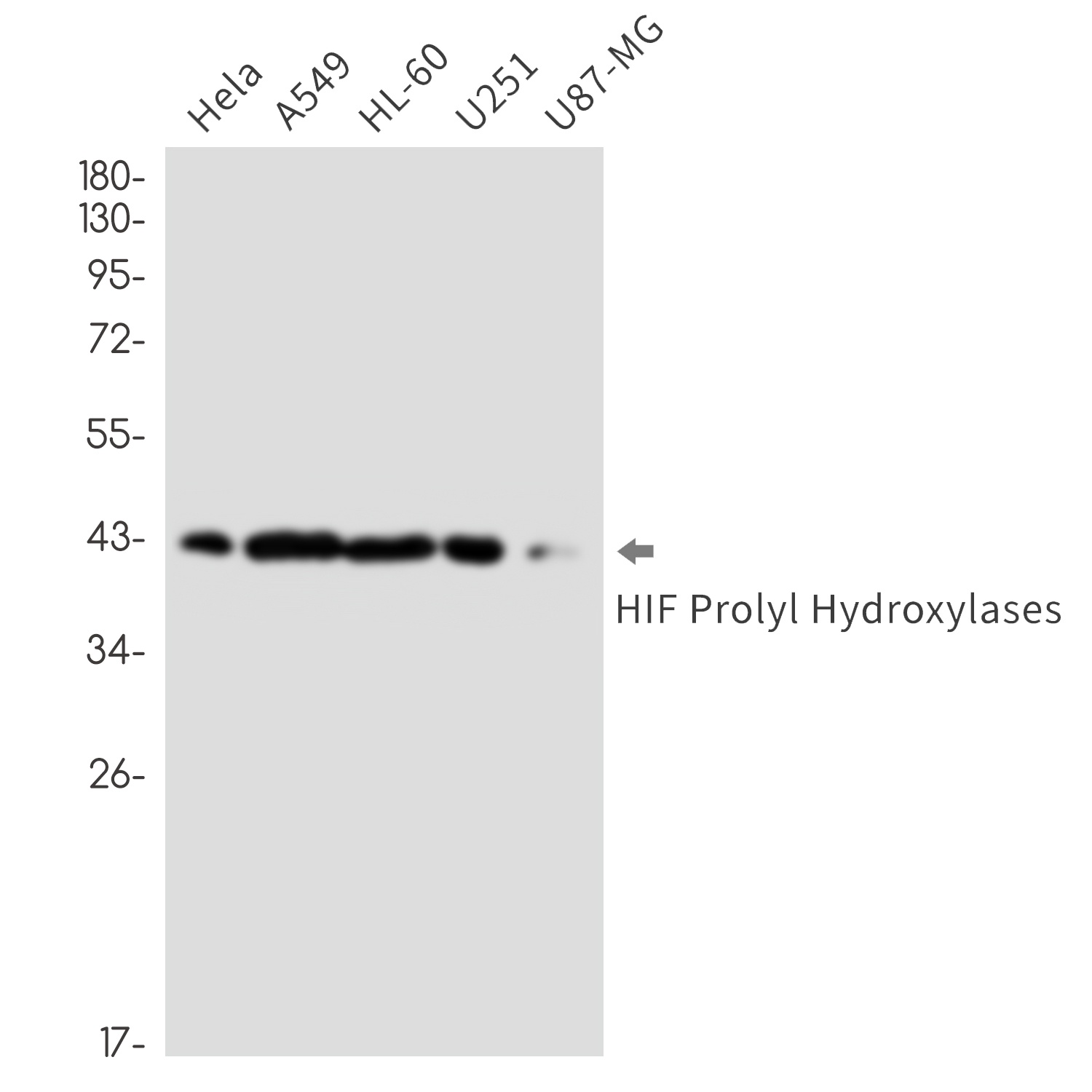 HIF Prolyl Hydroxylases Rabbit mAb