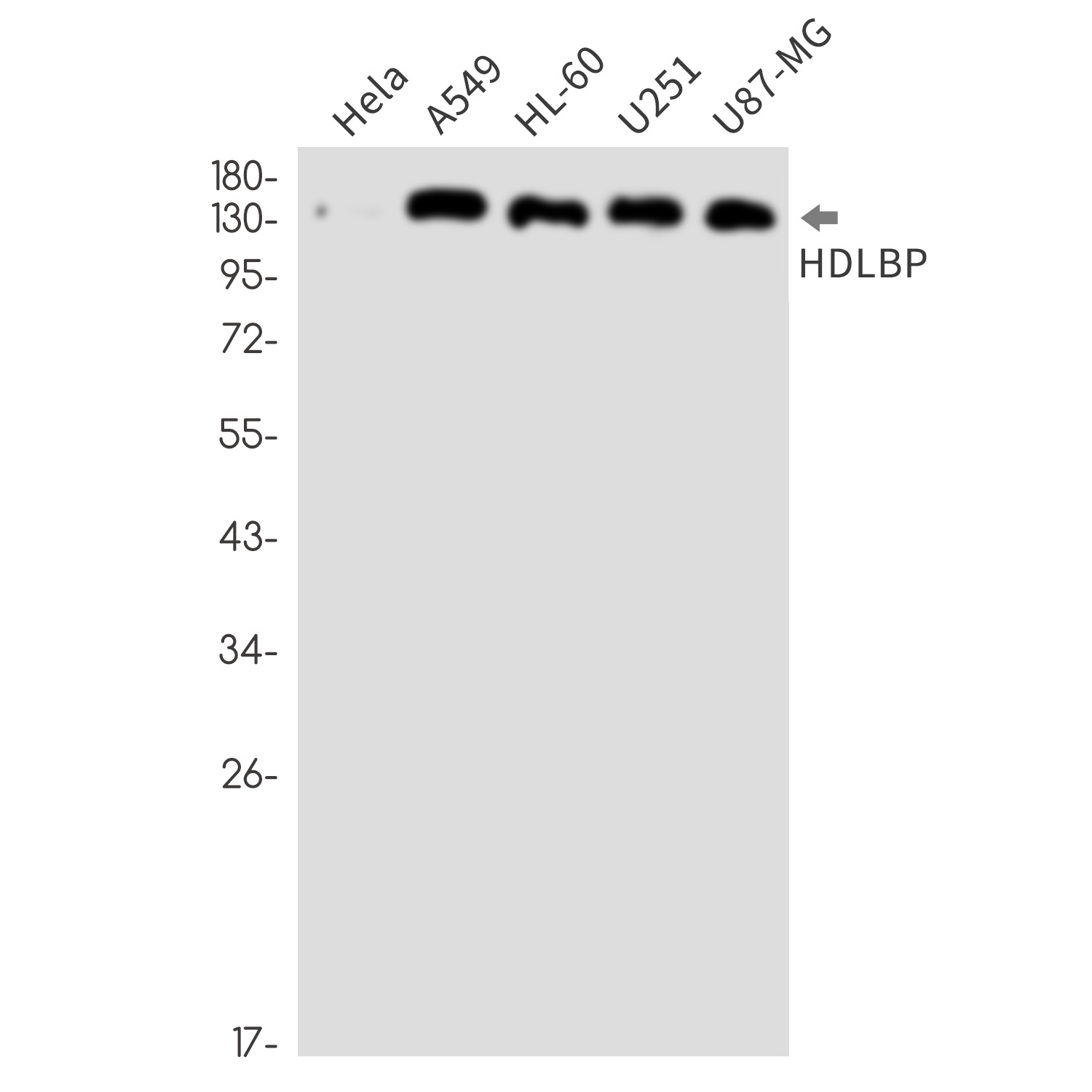 HDLBP Rabbit Monoclonal Antibody