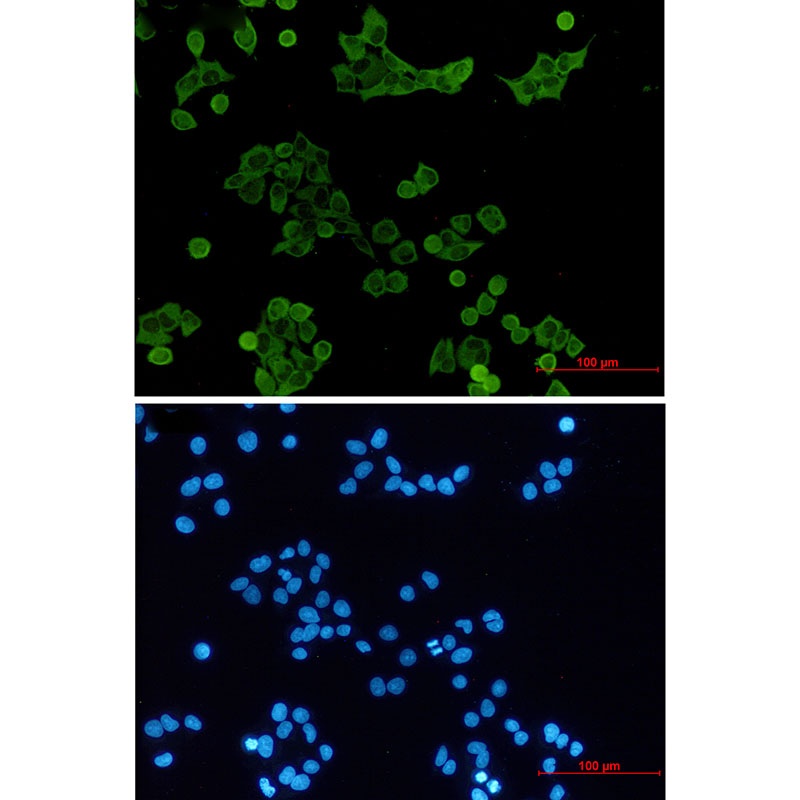 HCK Antibody
