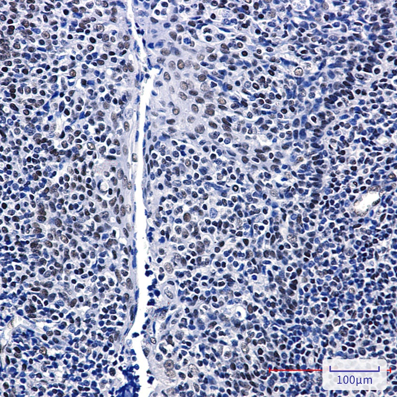 GTPBP4 Rabbit mAb