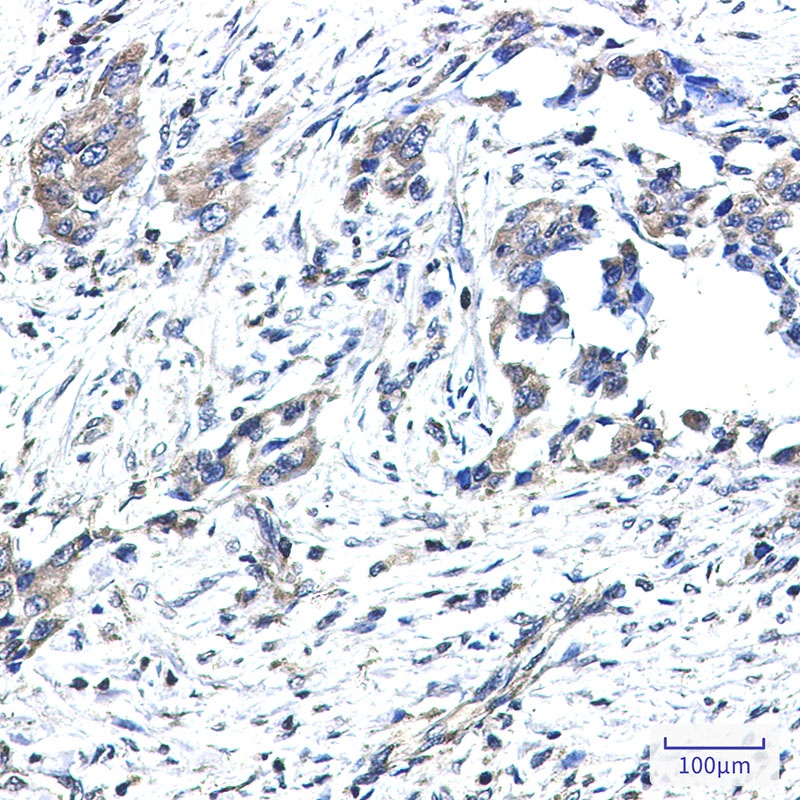 GNAI2 Rabbit mAb