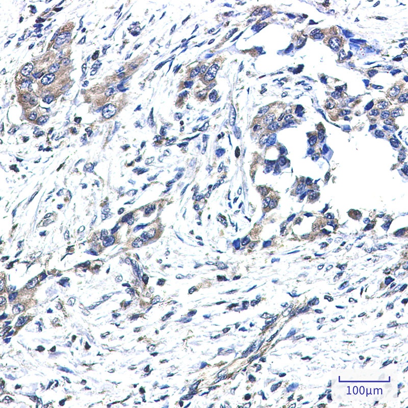 GNAI2 Antibody