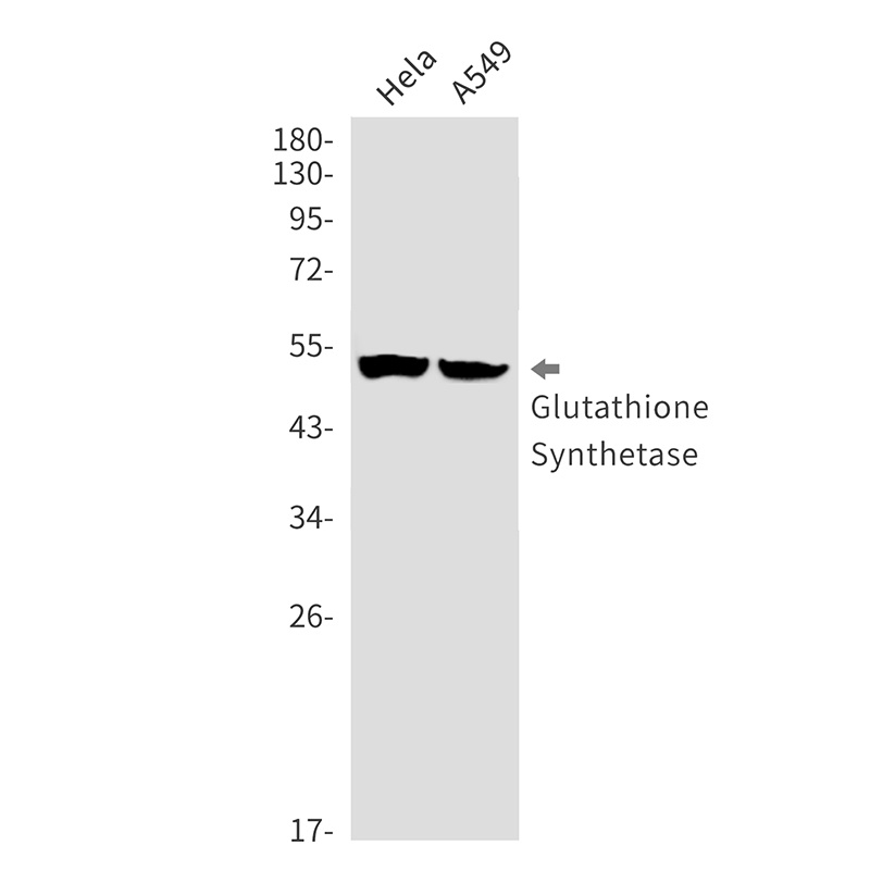 Glutathione Synthetase Rabbit Monoclonal Antibody