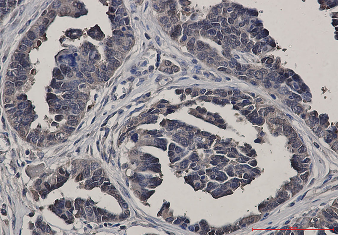 Glutathione Synthetase Rabbit Monoclonal Antibody