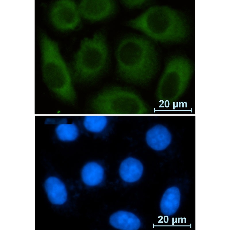 G6PD Antibody