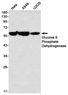 G6PD Antibody
