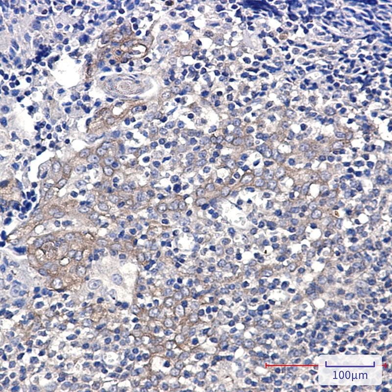 G6PD Antibody
