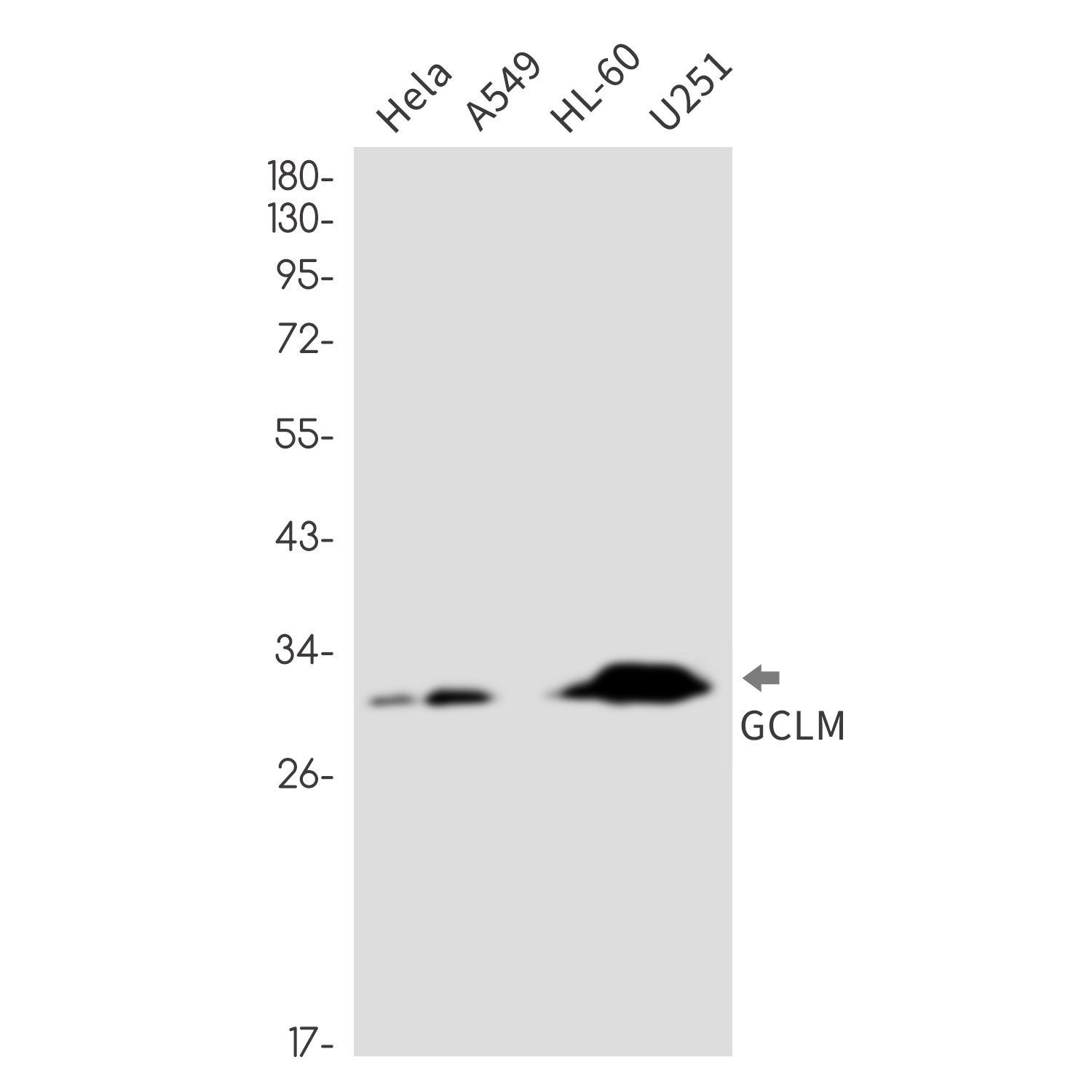 GCLM Antibody