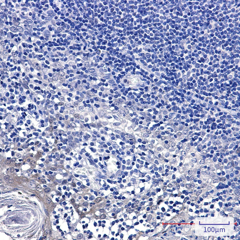 GCLM Antibody