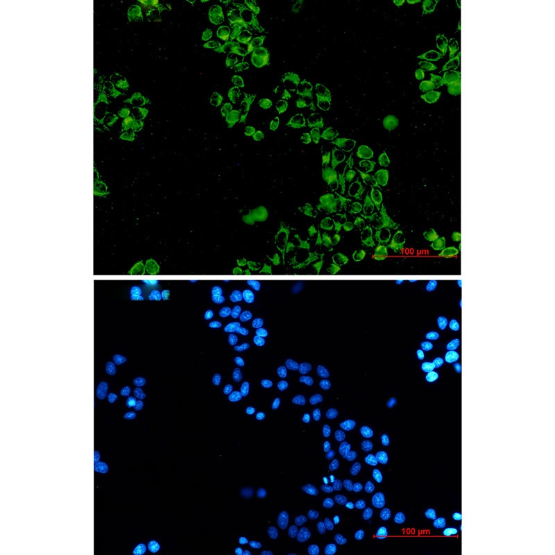 C1QBP Antibody