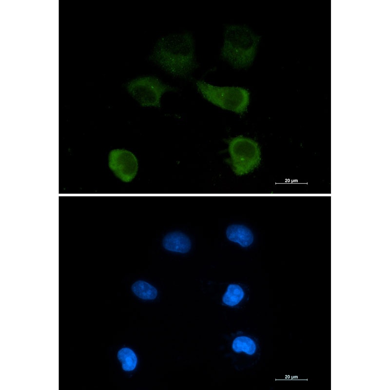 gamma Tubulin Rabbit mAb