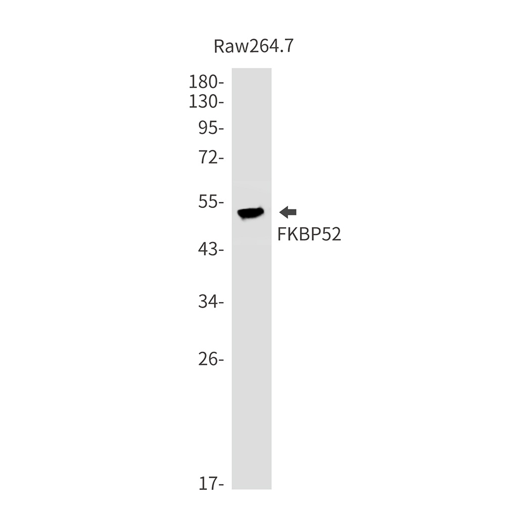 FKBP52 Rabbit mAb