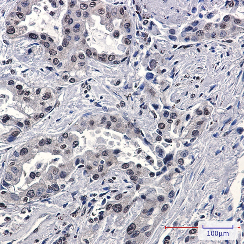 FKBP52 Rabbit mAb