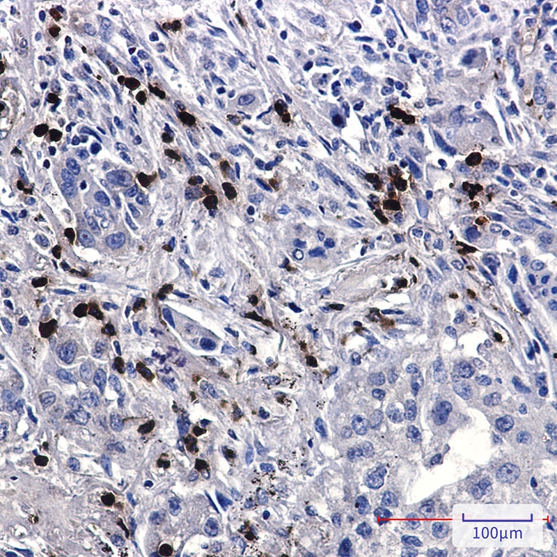 APBB1 Antibody