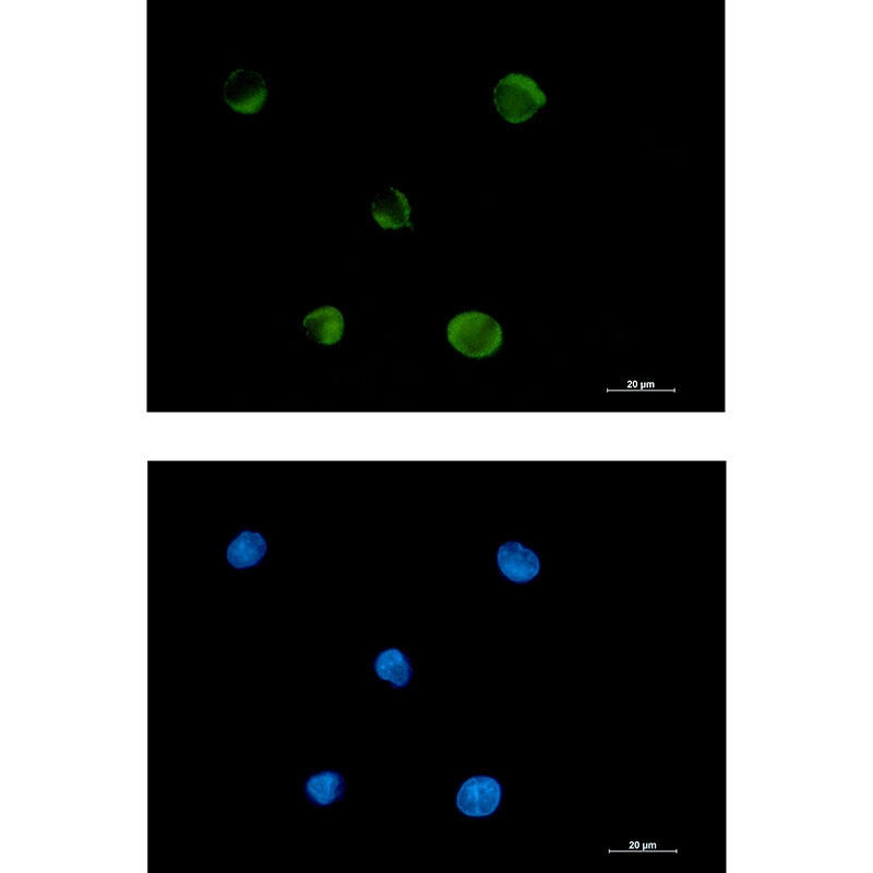 FADS1 Antibody