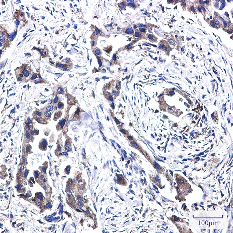 FADS1 Antibody