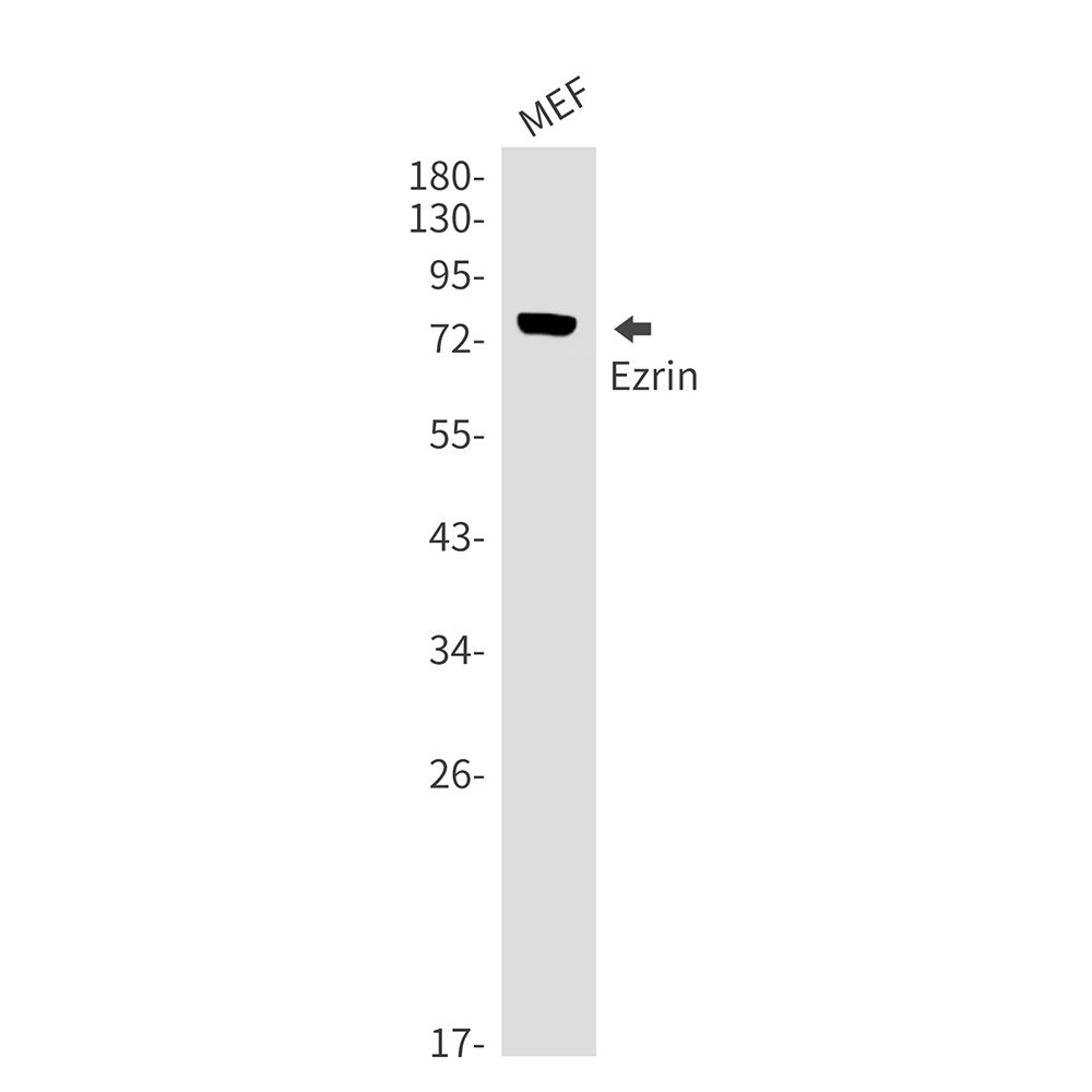 Ezrin Rabbit mAb