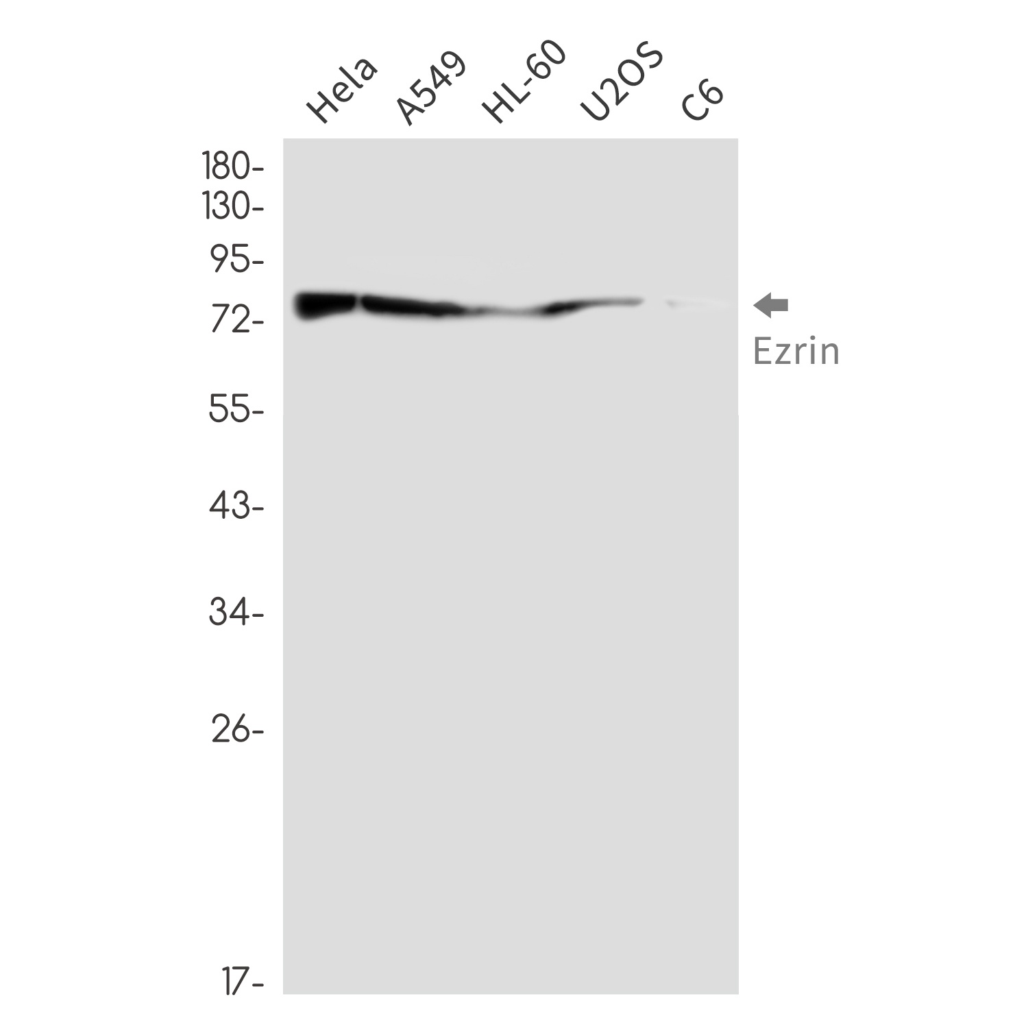 Ezrin Rabbit mAb