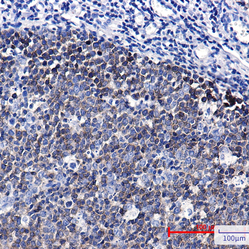Ezrin Rabbit mAb