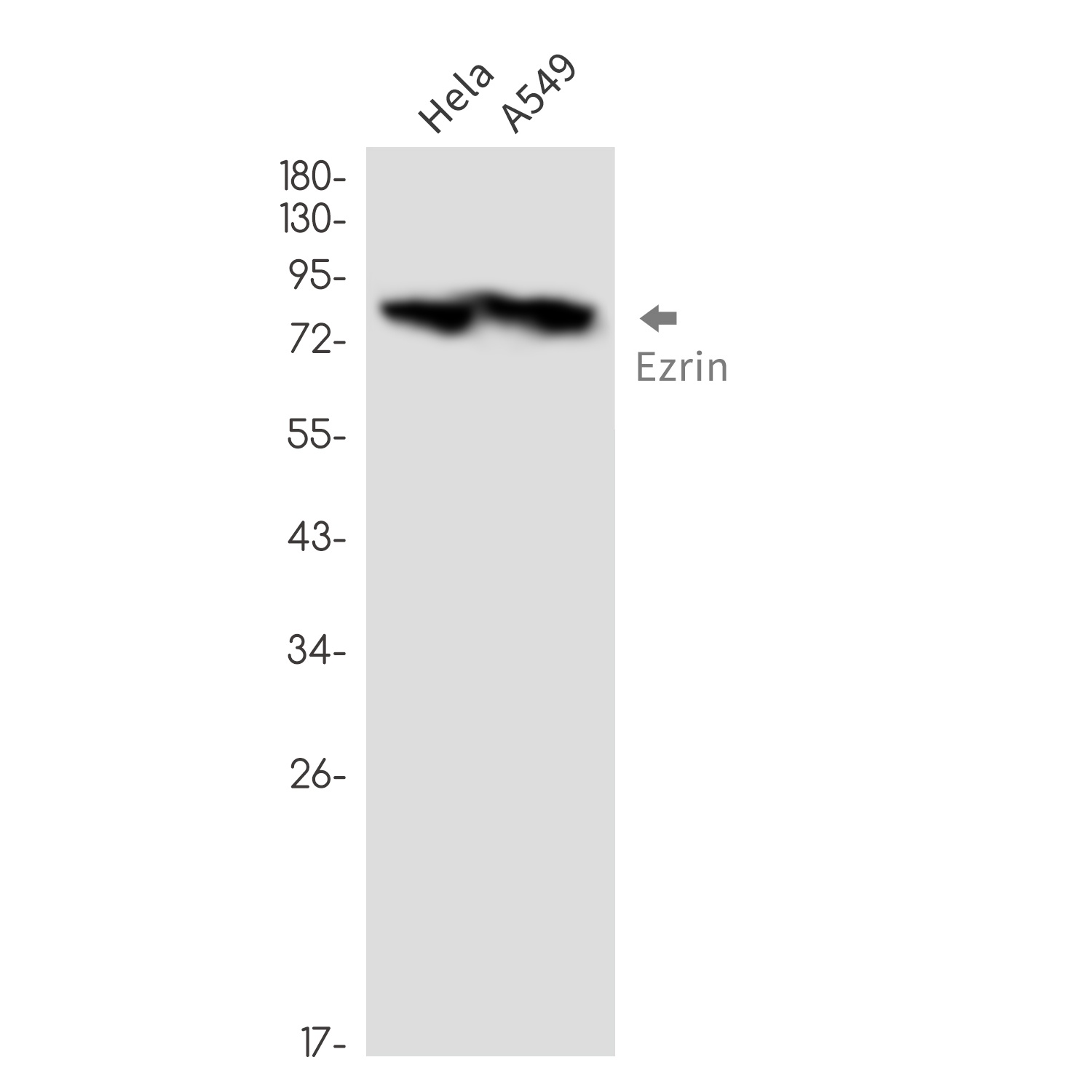Ezrin Rabbit mAb