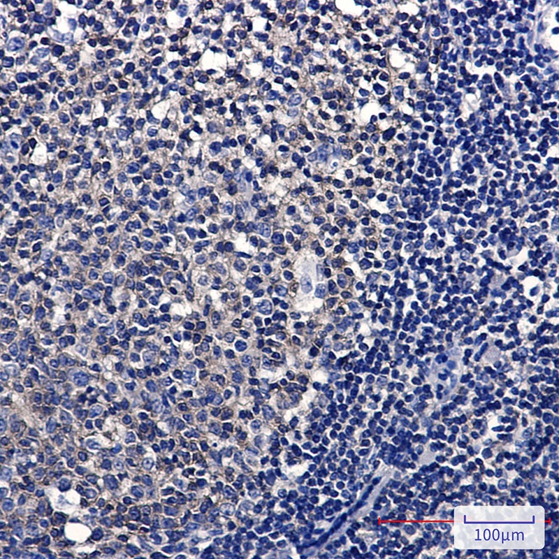 Ezrin Rabbit mAb