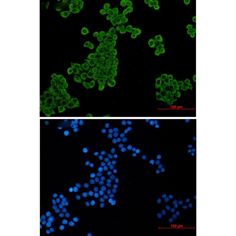 Elongation factor 2 Rabbit mAb