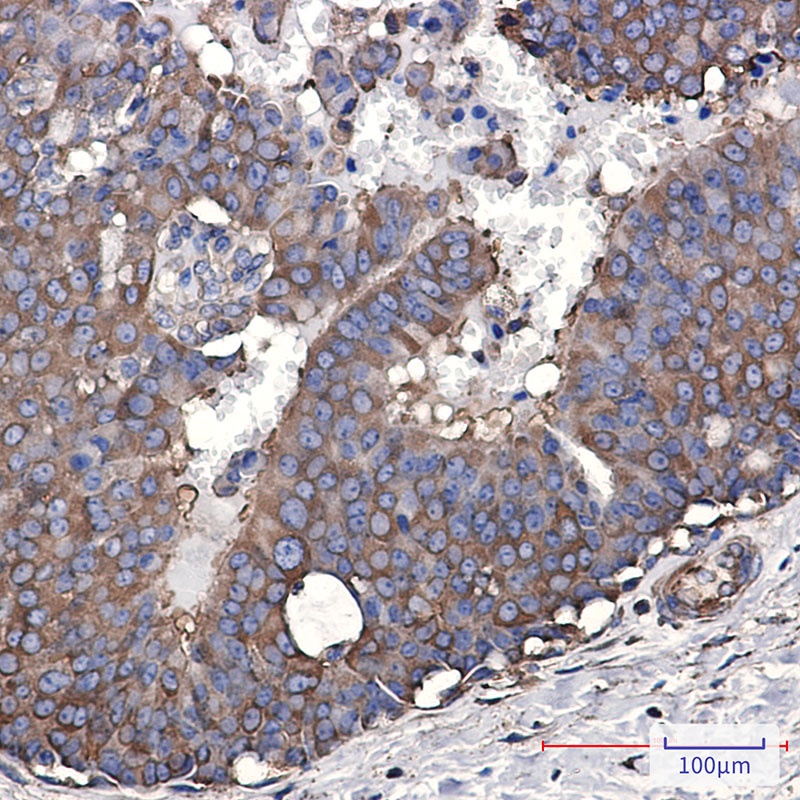 Elongation factor 2 Rabbit mAb