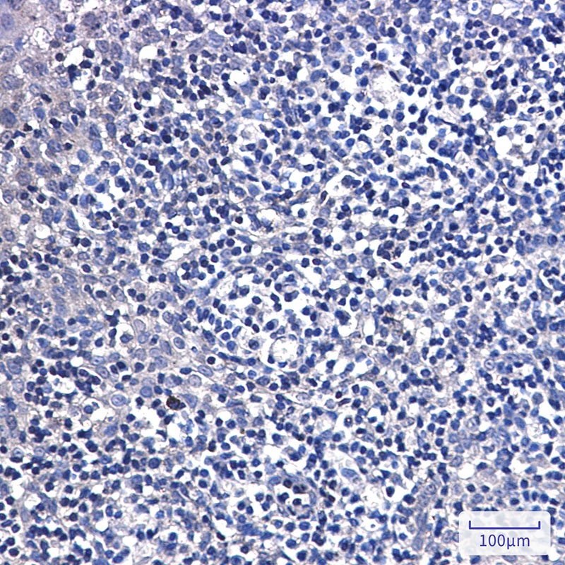 DTYMK Antibody