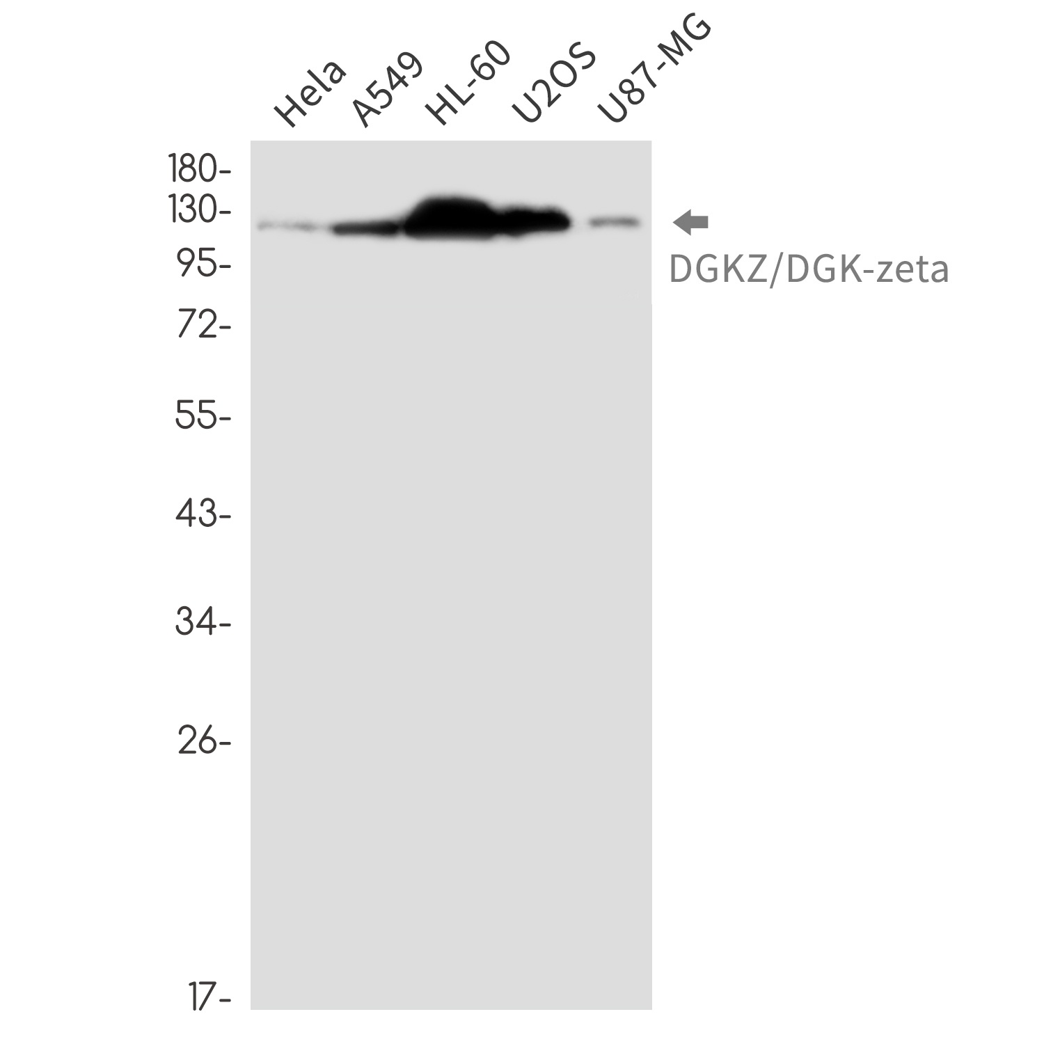 DGKZ/DGK-zeta Rabbit Monoclonal Antibody