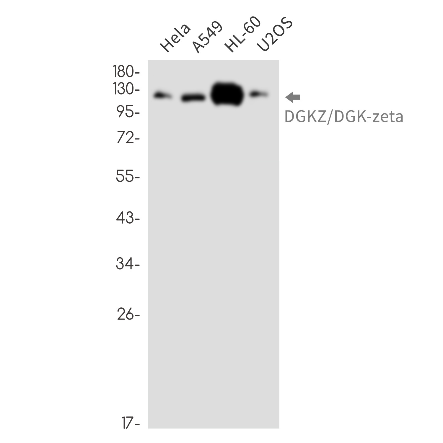 DGKZ/DGK-zeta Rabbit Monoclonal Antibody