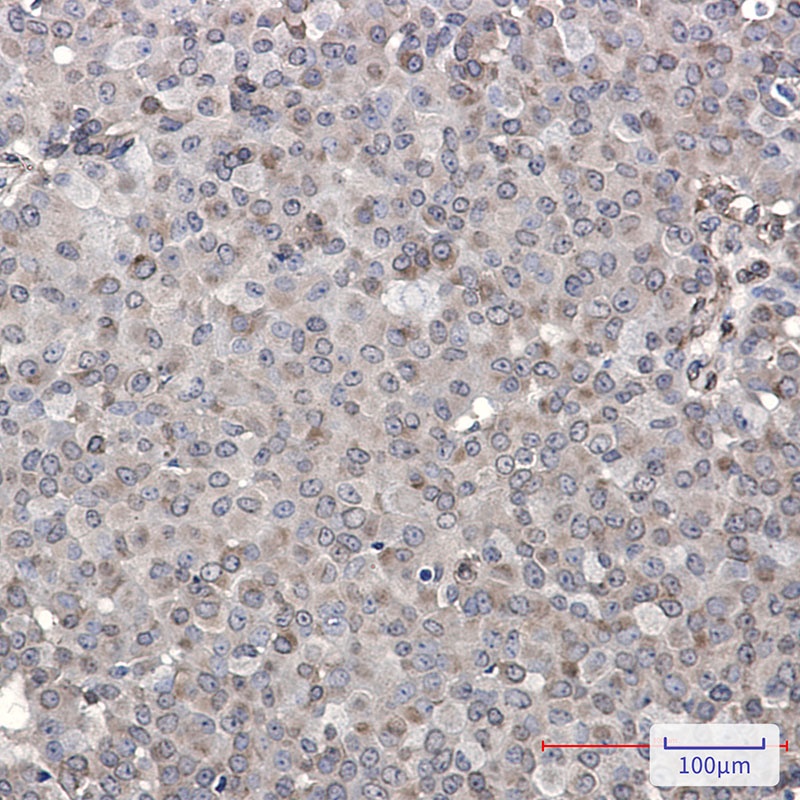 MADD Antibody