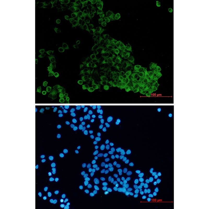 MADD Antibody