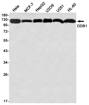 DDB1 Rabbit mAb
