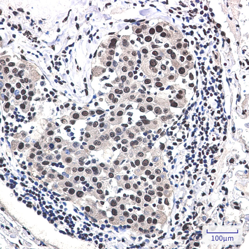 DDB1 Rabbit mAb