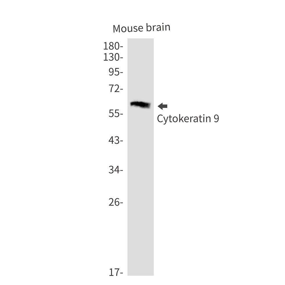 Cytokeratin 9 Rabbit mAb